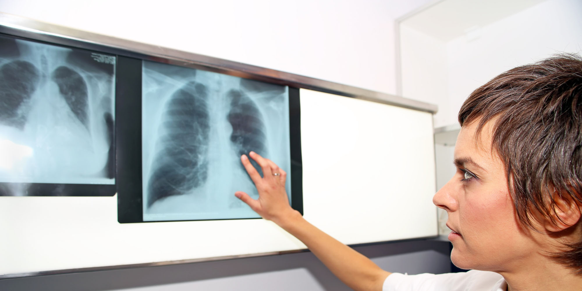 Pulmonary Embolism Response